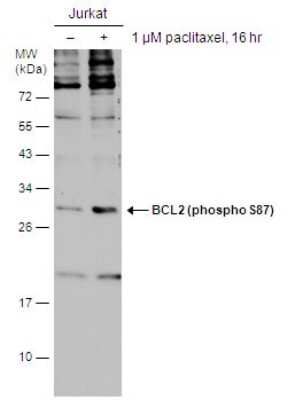 Western Blot: Bcl-2 [p Ser87] Antibody [NBP3-12896]